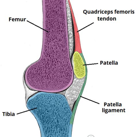 Quadriceps Tendon Rupture Teachmesurgery