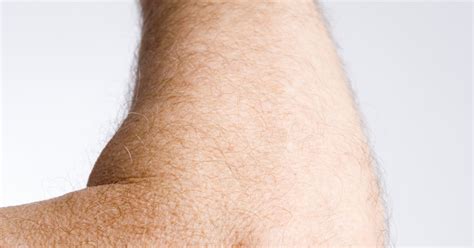 Elbow Skin Pain Livestrongcom