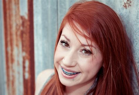 Redhead With Braces