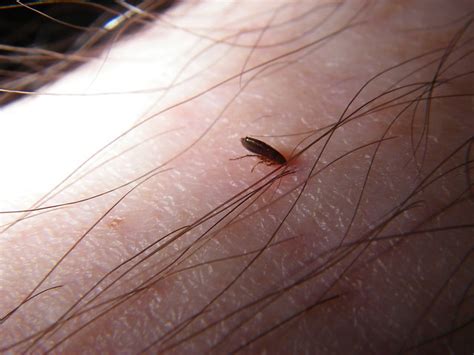Can humans get fleas in their hair? Flea on John's Leg | Flickr - Photo Sharing!