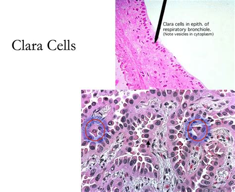 Respiratory Clara Cells Histology Histología