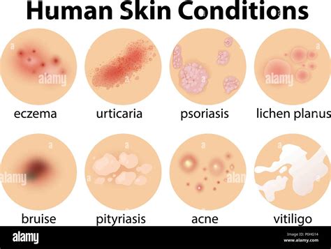 A Set Of Human Skin Conditions Illustration Stock Vector Image And Art Alamy