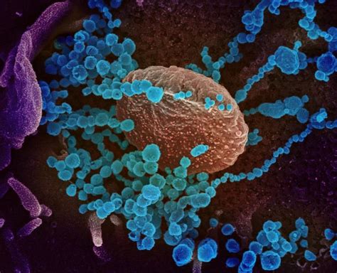 You may start to notice symptoms 2 to 14 days after you're exposed to the virus. 'Deeply concerned' WHO declares COVID-19 pandemic | CIDRAP