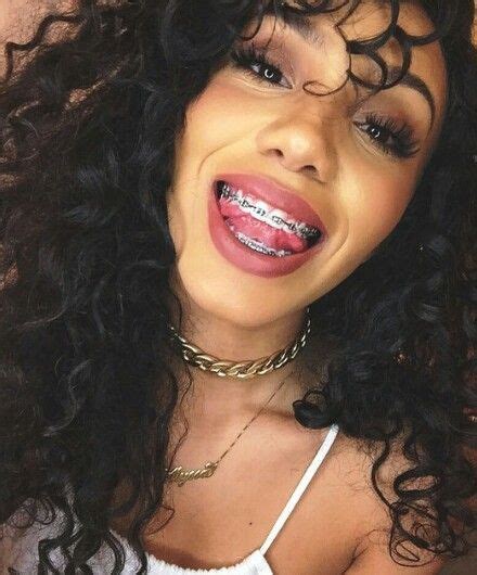 View the daily youtube analytics of 163 braces and track progress charts, view future predictions, related channels, and track realtime live sub counts. 163 best Braces Colors images on Pinterest | Braces colors ...