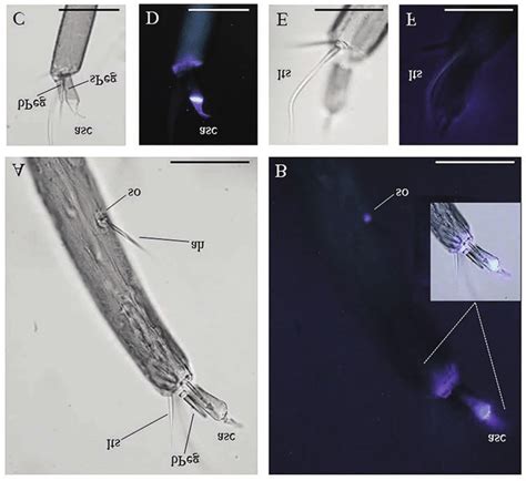 Antennal Sensory Organs In Ae Albopictus Fourth Instar Larvae Bright Download Scientific