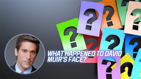 What Happened To David Muir S Face Endante