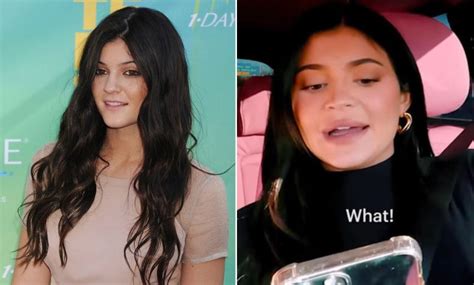 kylie jenner is accused of getting botched up lip fillers as fans beg the star to return to a
