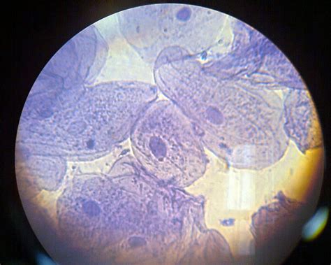 Célula Da Mucosa Bucal