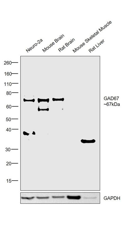Gad67 Polyclonal Antibody Pa5 94936