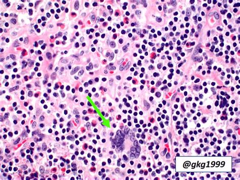 A Collection Of Surgical Pathology Images