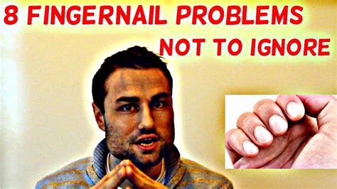 Try soaking your finger in a water/peroxide mix. 8 Fingernail Problems Not To Ignore - YouTube
