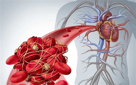 8 Signs You May Have A Blood Clot Aging Later
