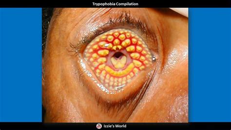 Pin On Trypophobia Images