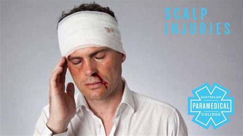 Scalp Injuries Australian Paramedical College Youtube