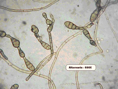 Mold Under A Microscope Create Your Healthy Home