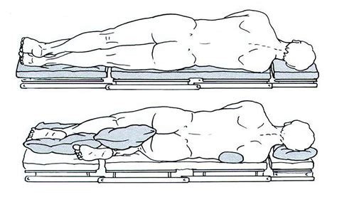 Surgical Positioning Lateral Decubitus Trialexhibits