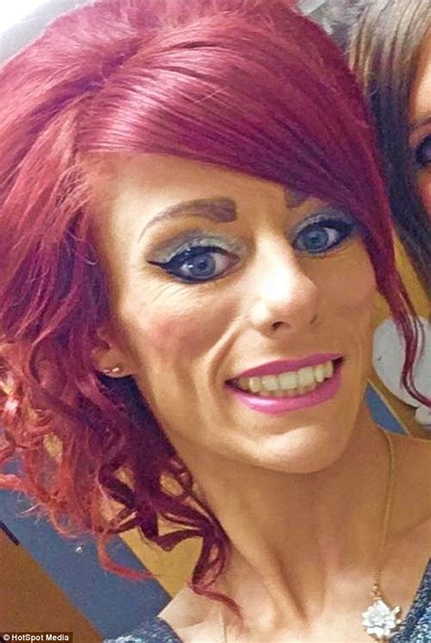 Woman Hits Back At Trolls Who Branded Her Anorexic Over Sunken Face