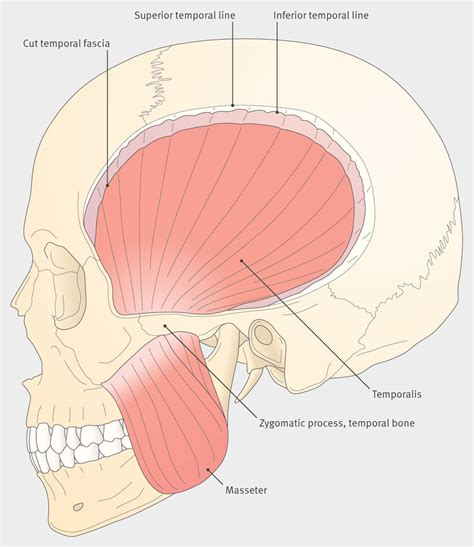 Diagram Of Temporalis Muscle