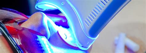 Teeth Whitening In Cedar Knolls Nj Cedar Knolls Dental Group