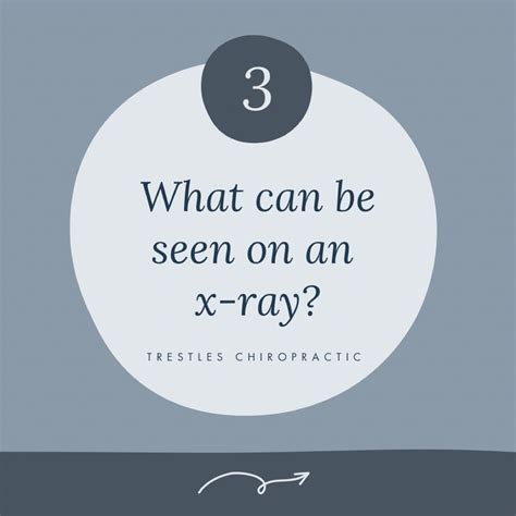 Ryan Anderson Dc On Linkedin X Rays Can Be Great To Track Any Progress Made In Your