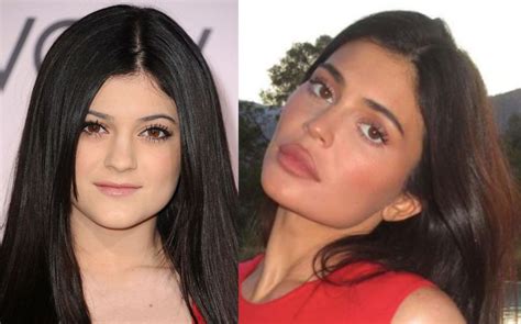 kylie jenner antes y después de sus cirugías estéticas fotos chic magazine