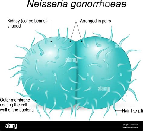 Neisseria Gonorrhoeae Gonococcus Is A Gram Negative Diplococci Bacteria Causes The Sexually