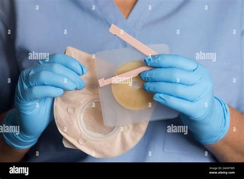 Colostomy Hi Res Stock Photography And Images Alamy