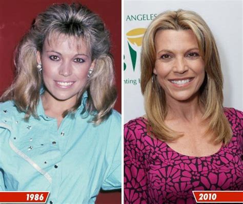 Vanna White Plastic Surgery Before After Joyce Meyero