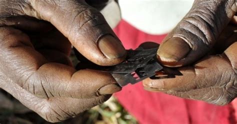 Is Fgm The Female Equivalence Of The Male Circumcision