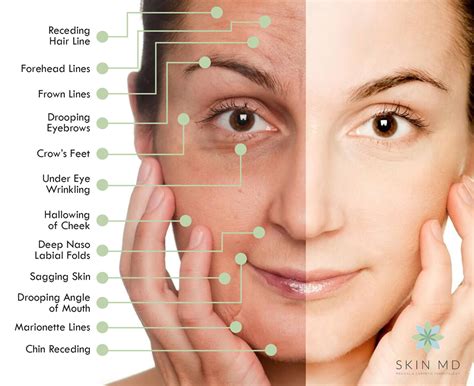 The Anatomy Of An Aging Face Skin MD Dermatologist In Ortigas Pasig