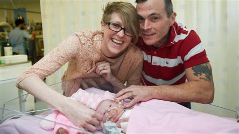 Baby Survives After Being Born With Heart Outside Her Body Youtube