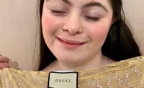 Gucci Beauty Campaign Features A Teenage Model With Down Syndrome Otosection