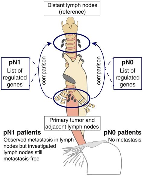 Lymph Nodes Of Two Different Patient Groups Suffering Pn1 Or Not