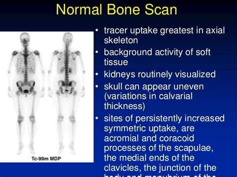 Bone Scan