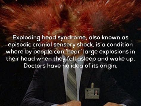 Pin By Kevin On Interesting Stuff How To Fall Asleep Exploding Head