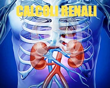 Gli alimenti da evitare (o limitare) per prevenire i calcoli renali sono: AmicoMario: ALIMENTAZIONE E CALCOLOSI. LO STRETTO LEGAME ...