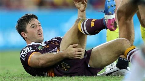 Nrl Injuries 2017 Casualty Ward Round 6 Daily Telegraph