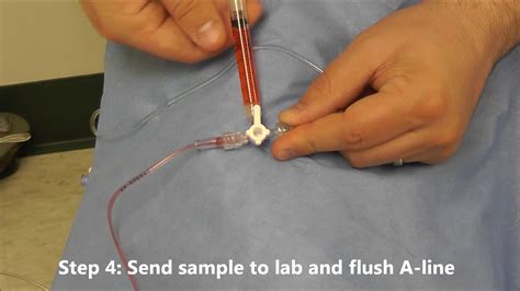 How To Draw Labs From A Picc Line At How To Draw