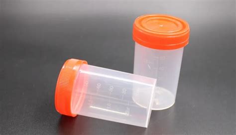 Hospital 60ml Graduated Urine Collection Container Urine Sample Cup