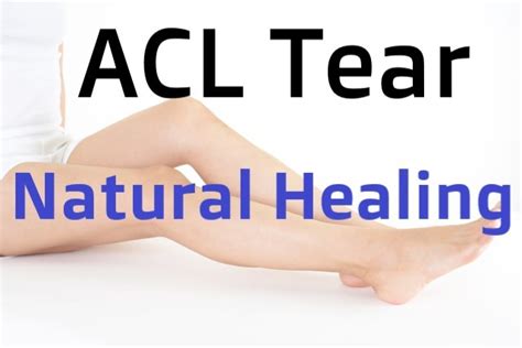 Natural Healing Of A Complete Acl Tear Case 26