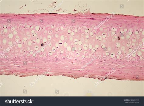 Human Hyaline Cartilage Section Under Microscope Foto De Stock