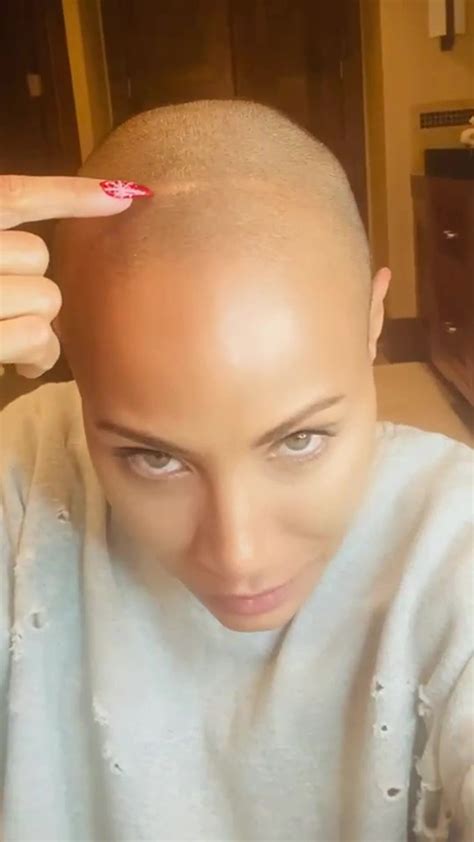 Jada Pinkett Smith Shares Update On Hair Loss Due To Alopecia