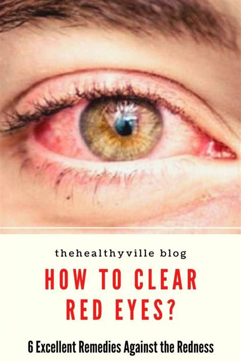 Pollen, pet dander, grass and ragweed. How to Clear Red Eyes? - 6 Excellent Remedies Against the ...