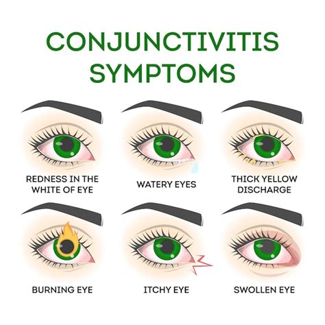 Premium Vector Conjunctivitis Symptoms Pink Eye Disease Infection