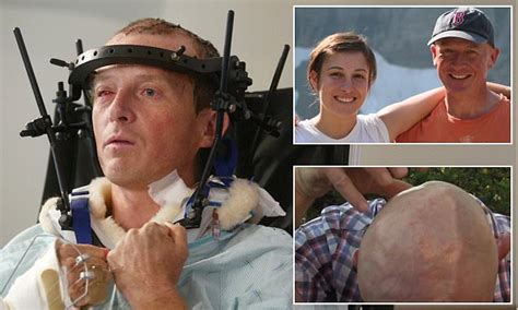 Those based on the peculiar use of colloquial constructions. Miracle survivor of grizzly bear attack recalls his ...