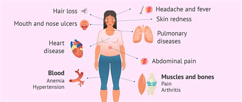 Symptoms And Diseases Caused By Sle