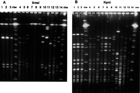 Sma I A And Kpn I B Pfge Patterns Of Selected C Jejuni And C Coli
