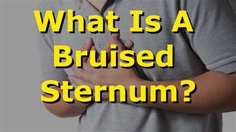 What Is A Bruised Sternum Youtube
