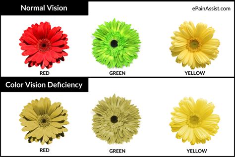 Color Blindness Or Color Vision Deficiencycausessymptoms