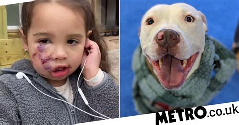 Fake Service Pit Bull That Mauled Toddlers Face Is Destroyed Metro